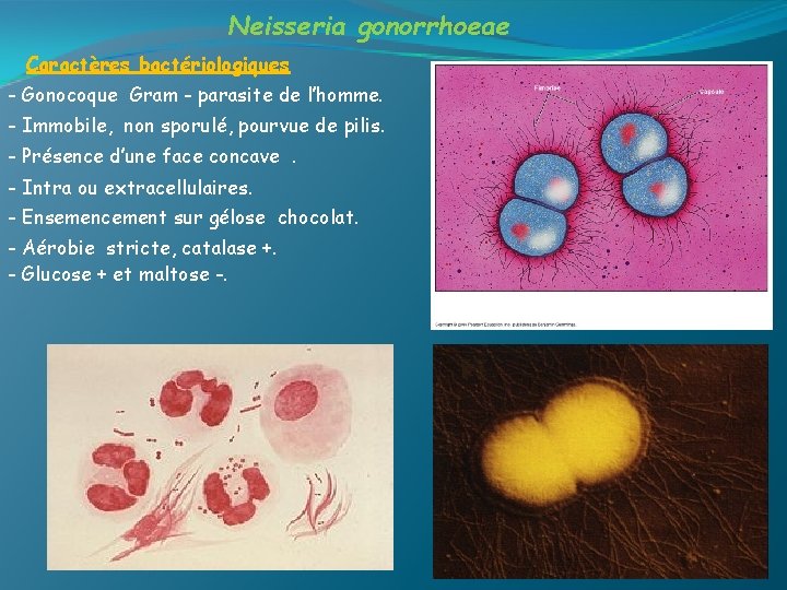 Neisseria gonorrhoeae Caractères bactériologiques - Gonocoque Gram - parasite de l’homme. - Immobile, non