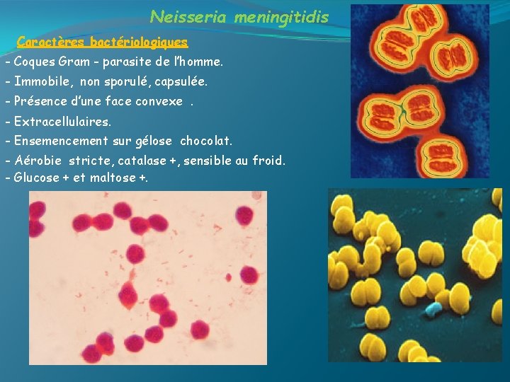 Neisseria meningitidis Caractères bactériologiques - Coques Gram - parasite de l’homme. - Immobile, non