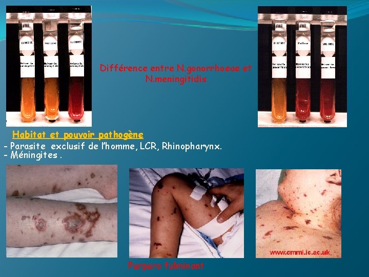 Différence entre N. gonorrhoeae et N. meningitidis Habitat et pouvoir pathogène - Parasite exclusif