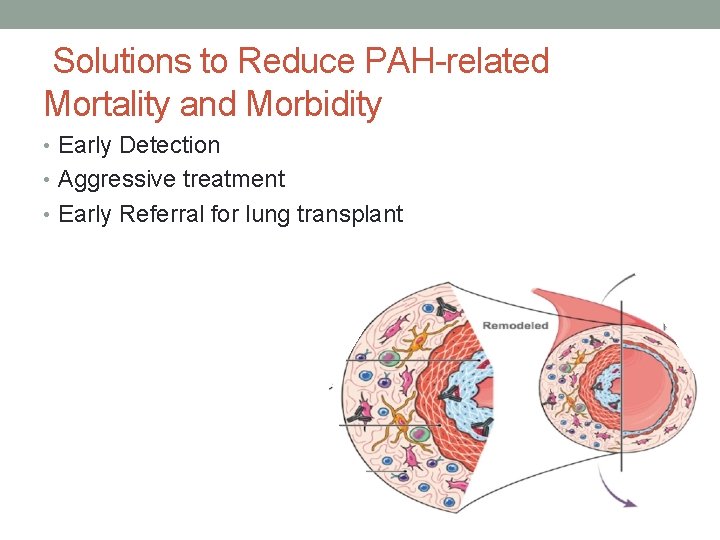 Solutions to Reduce PAH-related Mortality and Morbidity • Early Detection • Aggressive treatment •