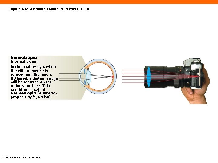 Figure 9 -17 Accommodation Problems (2 of 3) Emmetropia (normal vision) In the healthy