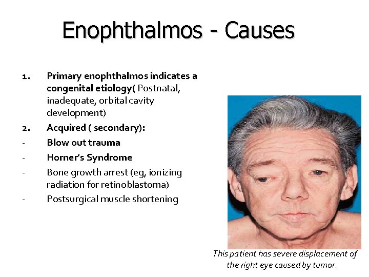 Enophthalmos - Causes 1. 2. - Primary enophthalmos indicates a congenital etiology( Postnatal, inadequate,