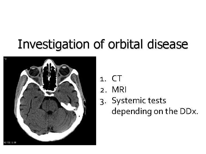 Investigation of orbital disease 1. CT 2. MRI 3. Systemic tests depending on the