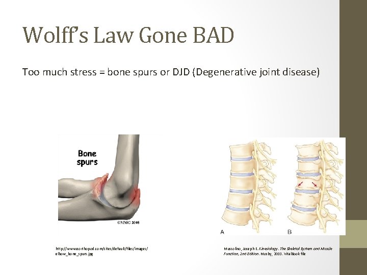 Wolff’s Law Gone BAD Too much stress = bone spurs or DJD (Degenerative joint