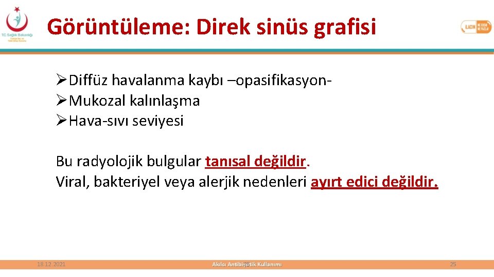 Görüntüleme: Direk sinüs grafisi ØDiffüz havalanma kaybı –opasifikasyonØMukozal kalınlaşma ØHava-sıvı seviyesi Bu radyolojik bulgular