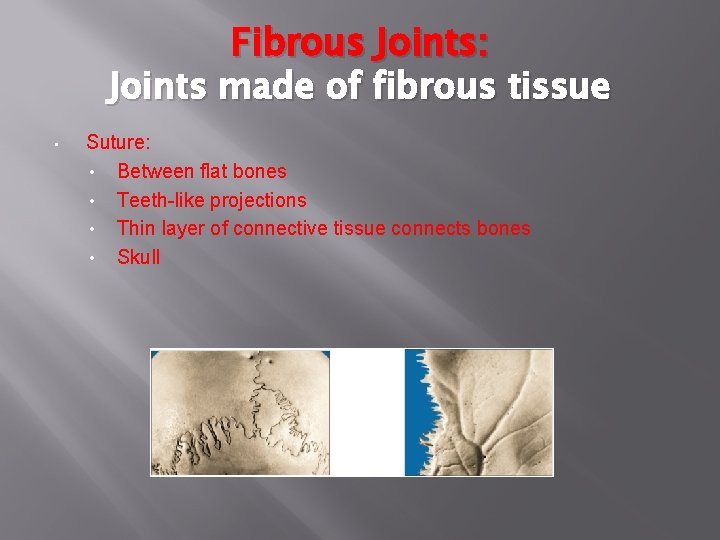 Fibrous Joints: Joints made of fibrous tissue • Suture: • Between flat bones •
