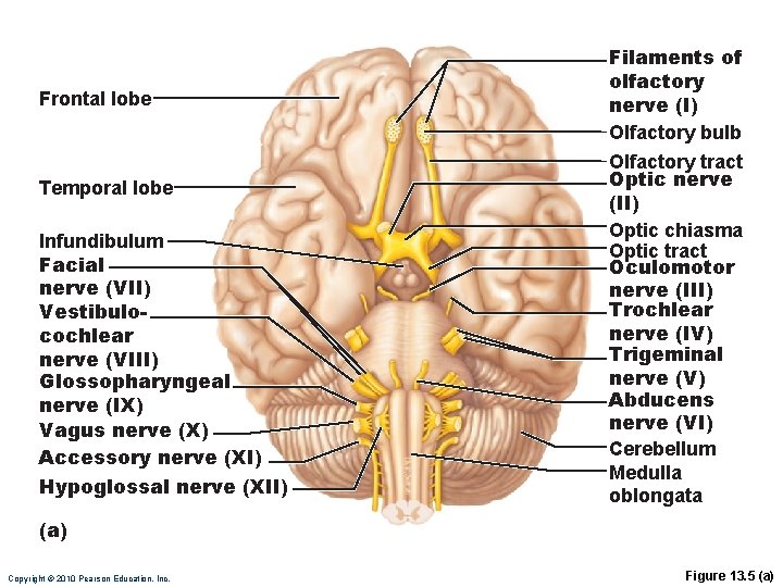 Frontal lobe Temporal lobe Infundibulum Facial nerve (VII) Vestibulocochlear nerve (VIII) Glossopharyngeal nerve (IX)