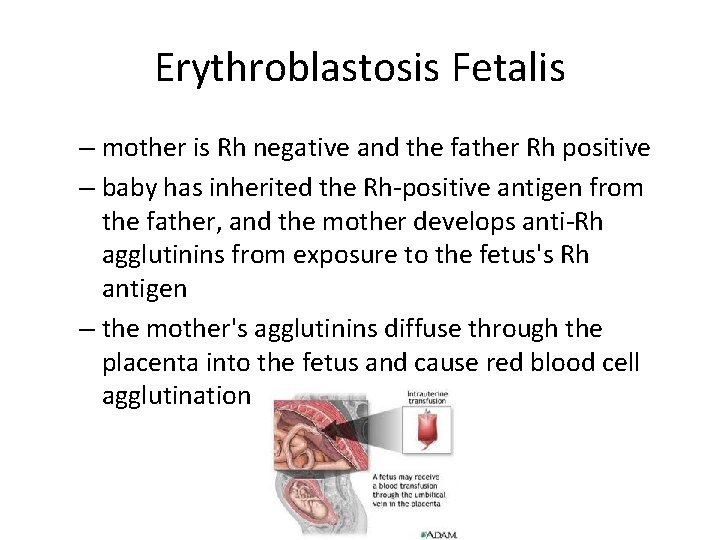 Erythroblastosis Fetalis – mother is Rh negative and the father Rh positive – baby