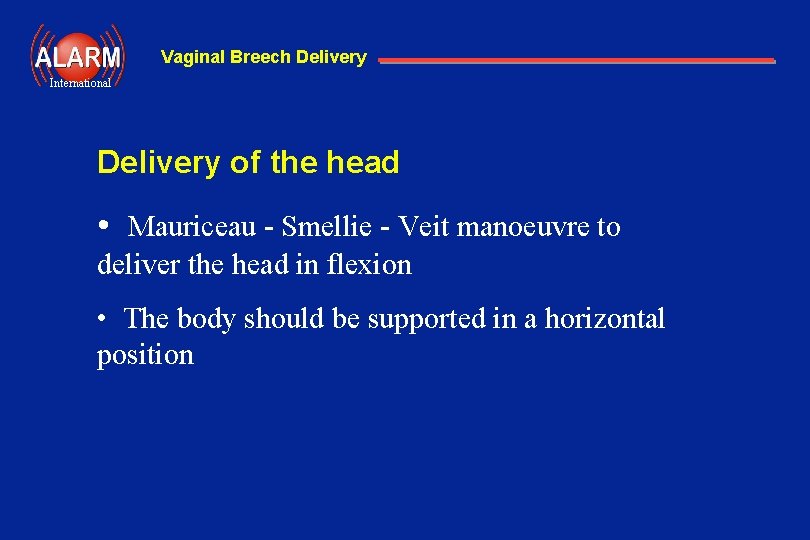 Vaginal Breech Delivery International Delivery of the head • Mauriceau - Smellie - Veit