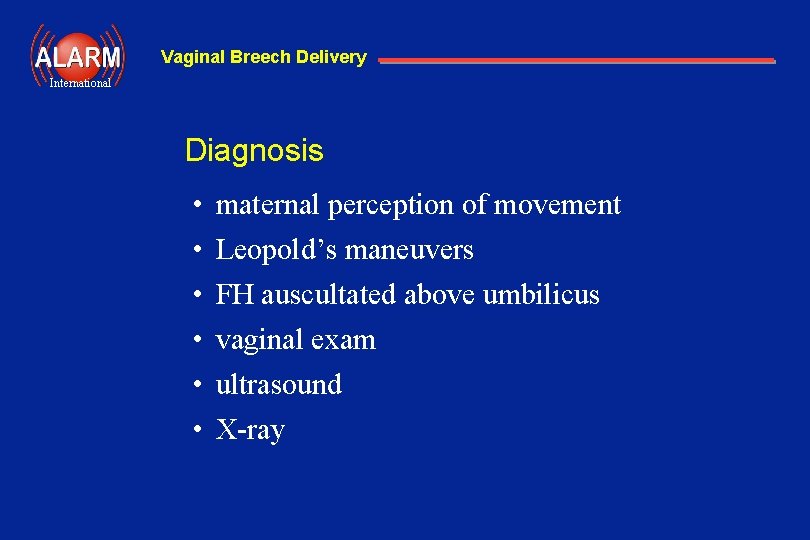 Vaginal Breech Delivery International Diagnosis • • • maternal perception of movement Leopold’s maneuvers