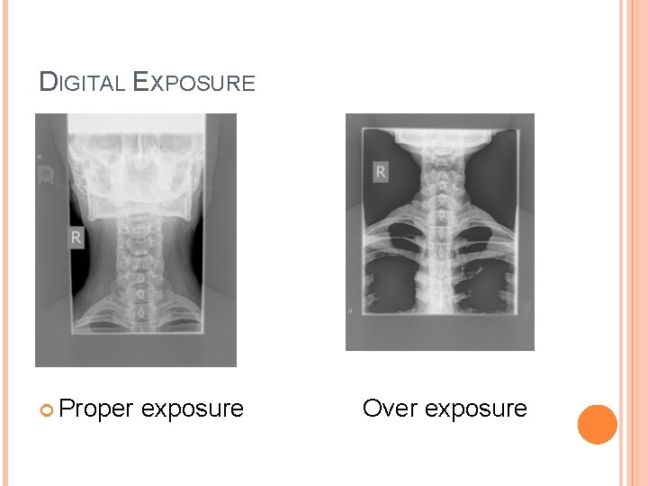 DIGITAL EXPOSURE Proper exposure Over exposure 