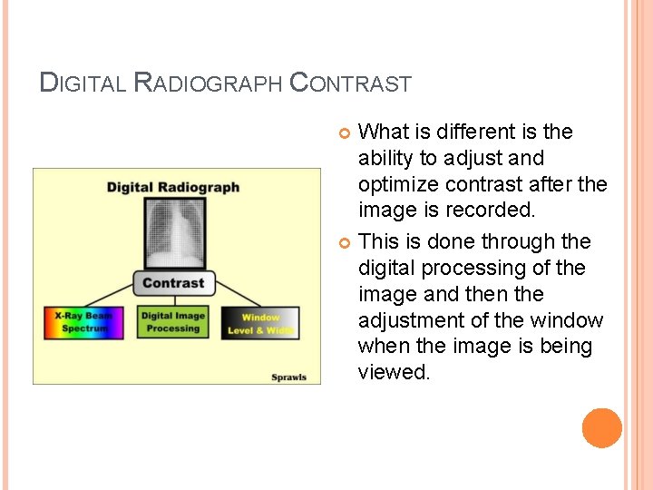 DIGITAL RADIOGRAPH CONTRAST What is different is the ability to adjust and optimize contrast