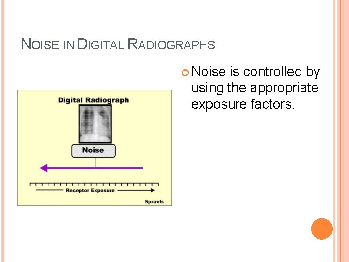 NOISE IN DIGITAL RADIOGRAPHS Noise is controlled by using the appropriate exposure factors. 