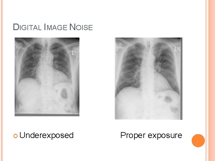 DIGITAL IMAGE NOISE Underexposed Proper exposure 