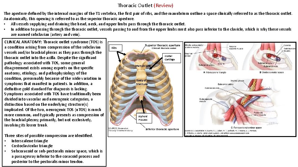 Thoracic Outlet (Review) The aperture defined by the internal margins of the T 1