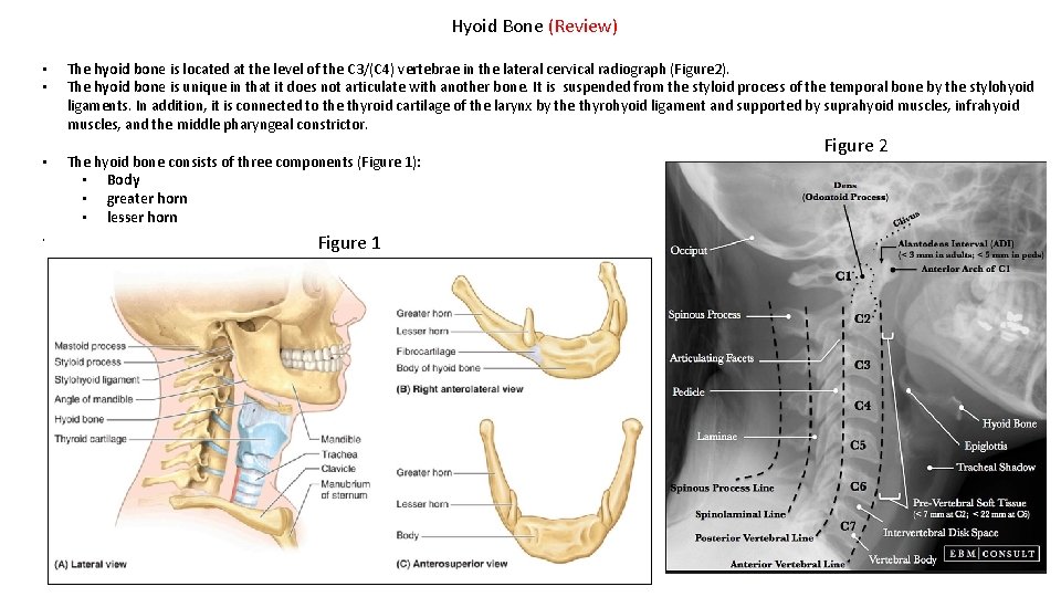 Hyoid Bone (Review) • • The hyoid bone is located at the level of