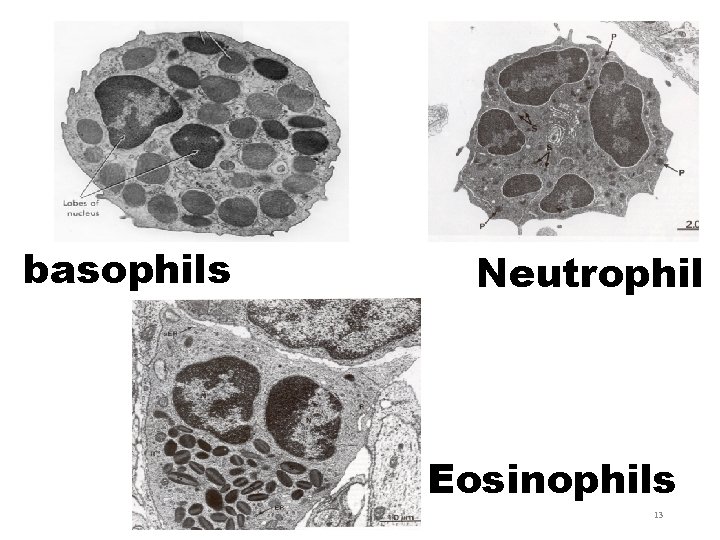 basophils Neutrophil Eosinophils 13 
