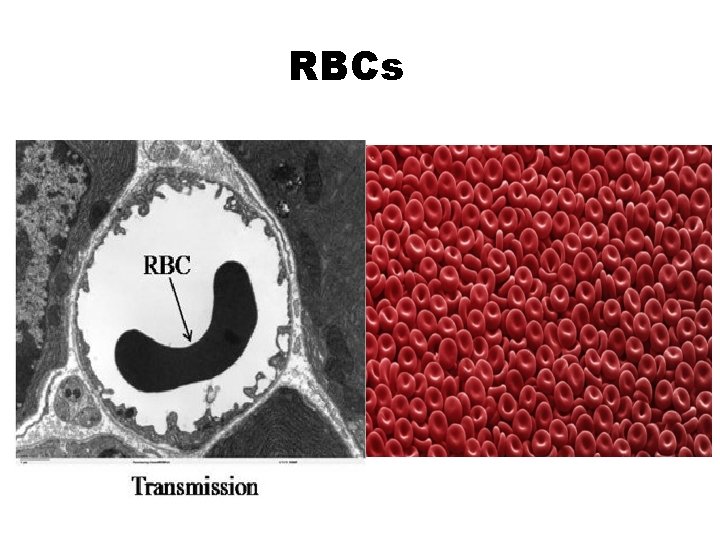RBCs 