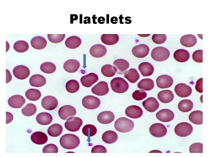 Platelets 
