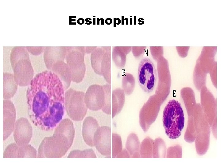 Eosinophils 