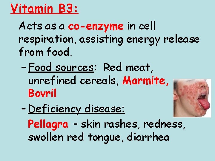 Vitamin B 3: Acts as a co-enzyme in cell respiration, assisting energy release from Vitamin B 3: Acts as a co-enzyme in cell respiration, assisting energy release from