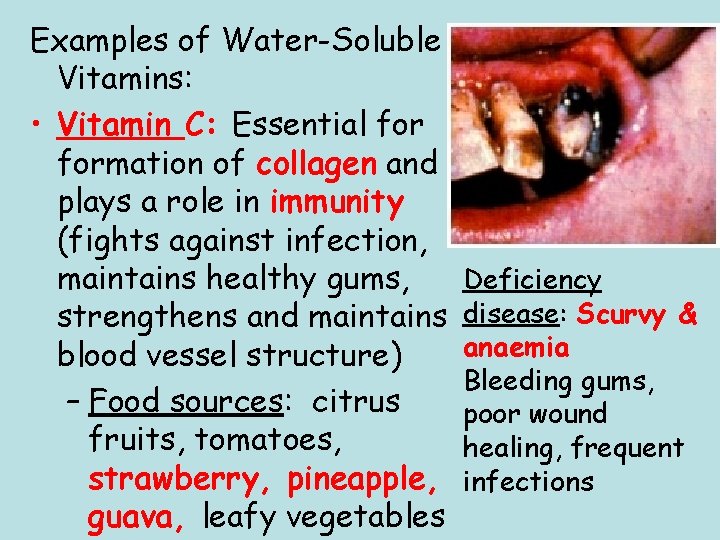 Examples of Water-Soluble Vitamins: • Vitamin C: Essential formation of collagen and plays a