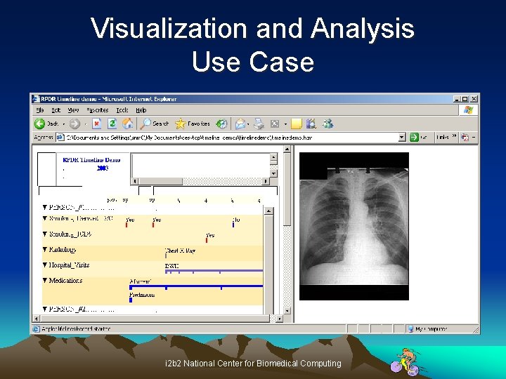 Visualization and Analysis Use Case i 2 b 2 National Center for Biomedical Computing