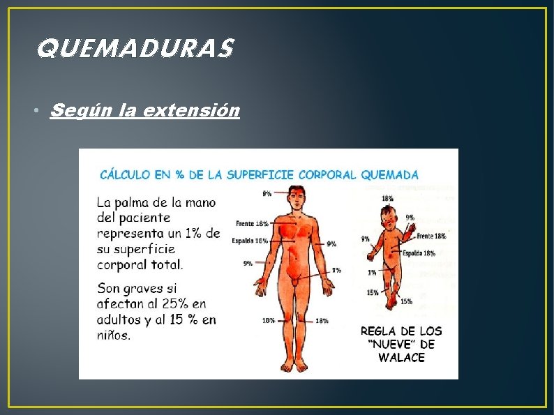 QUEMADURAS • Según la extensión 