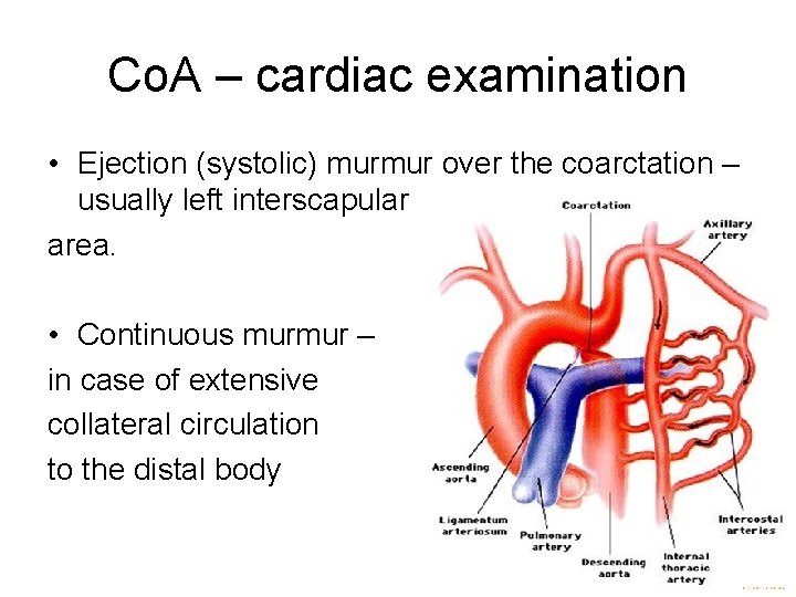 Co. A – cardiac examination • Ejection (systolic) murmur over the coarctation – usually