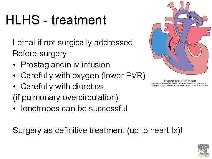 HLHS - treatment Lethal if not surgically addressed! Before surgery : • Prostaglandin iv