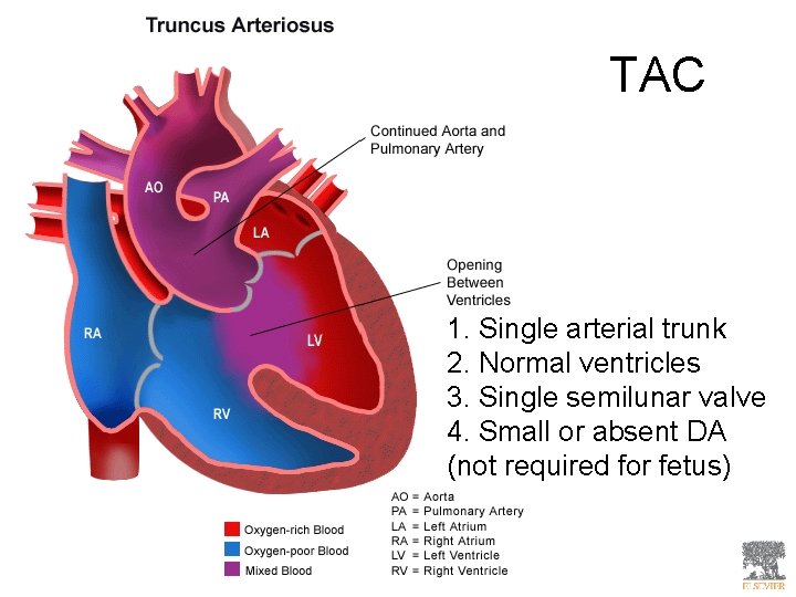 TAC 1. Single arterial trunk 2. Normal ventricles 3. Single semilunar valve 4. Small