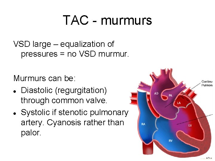 TAC - murmurs VSD large – equalization of pressures = no VSD murmur. Murmurs