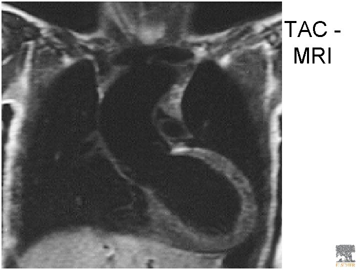 TAC MRI 