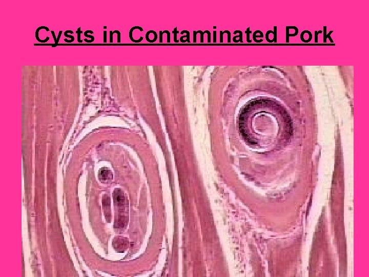 Cysts in Contaminated Pork 