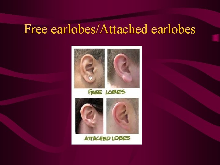 Free earlobes/Attached earlobes 