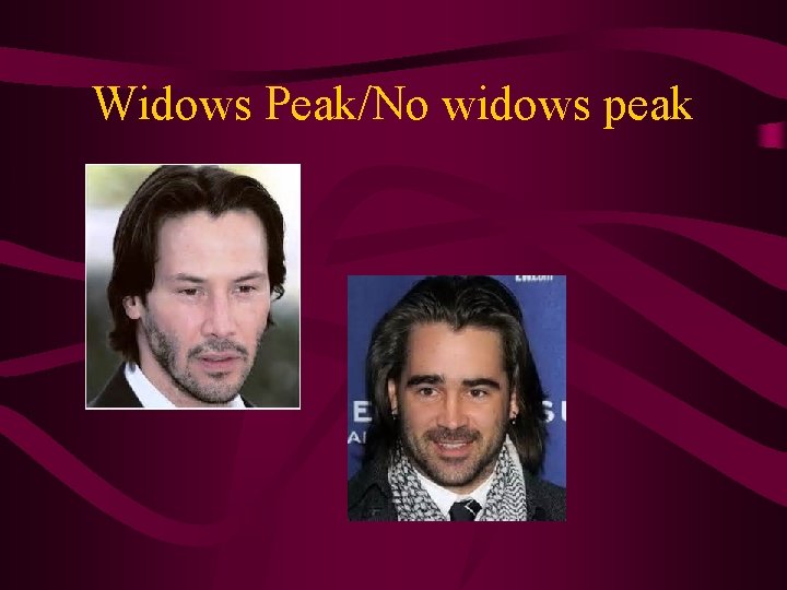 Widows Peak/No widows peak 