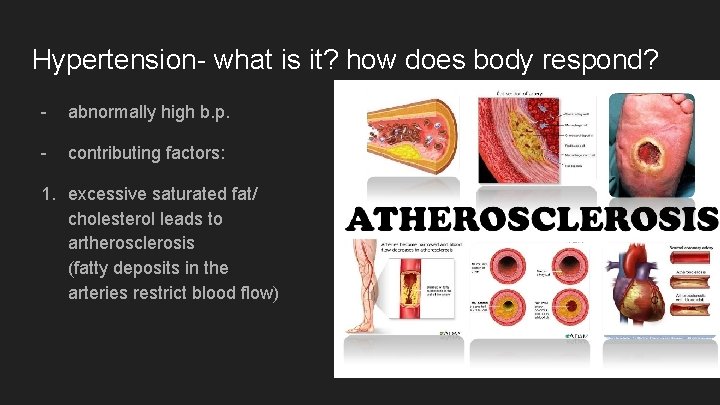 Hypertension- what is it? how does body respond? - abnormally high b. p. -