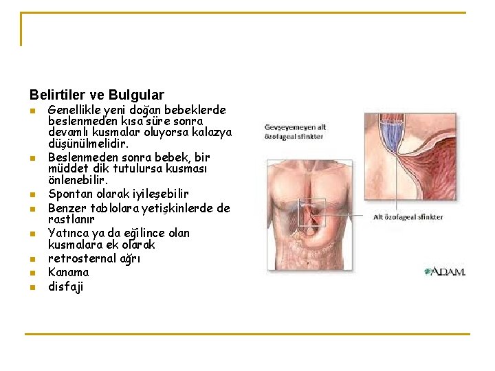 Belirtiler ve Bulgular n n n n Genellikle yeni doğan bebeklerde beslenmeden kısa süre