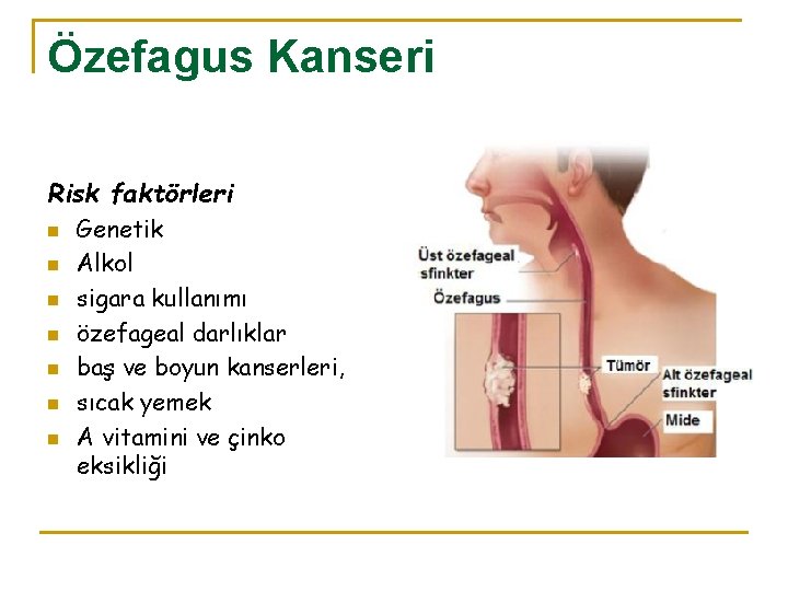 Özefagus Kanseri Risk faktörleri n n n n Genetik Alkol sigara kullanımı özefageal darlıklar