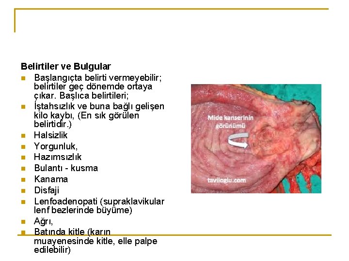 Belirtiler ve Bulgular n Başlangıçta belirti vermeyebilir; belirtiler geç dönemde ortaya çıkar. Başlıca belirtileri;