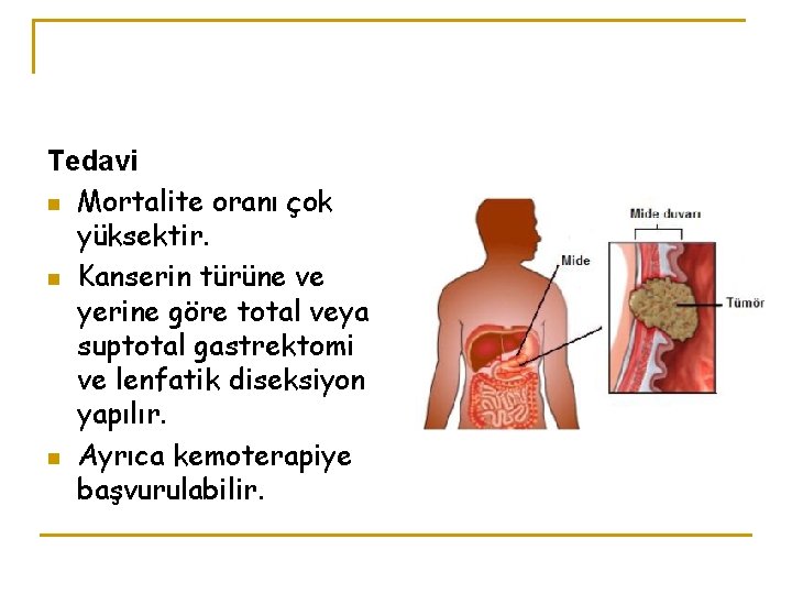 Tedavi n Mortalite oranı çok yüksektir. n Kanserin türüne ve yerine göre total veya