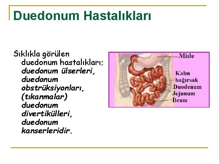 Duedonum Hastalıkları Sıklıkla görülen duedonum hastalıkları; duedonum ülserleri, duedonum obstrüksiyonları, (tıkanmalar) duedonum divertikülleri, duedonum