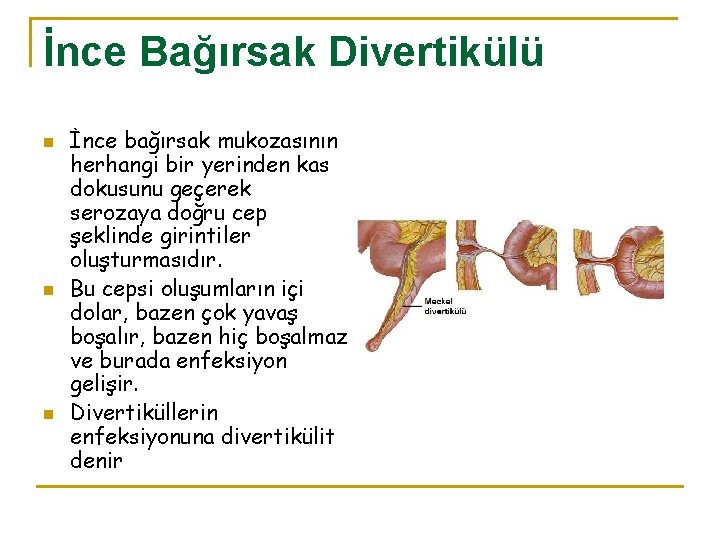 İnce Bağırsak Divertikülü n n n İnce bağırsak mukozasının herhangi bir yerinden kas dokusunu