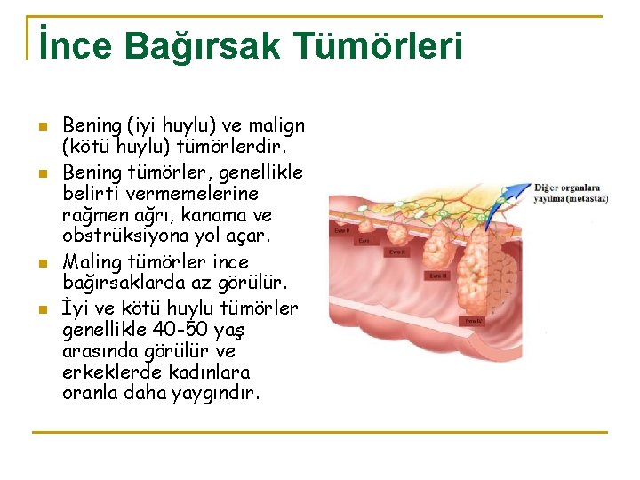 İnce Bağırsak Tümörleri n n Bening (iyi huylu) ve malign (kötü huylu) tümörlerdir. Bening