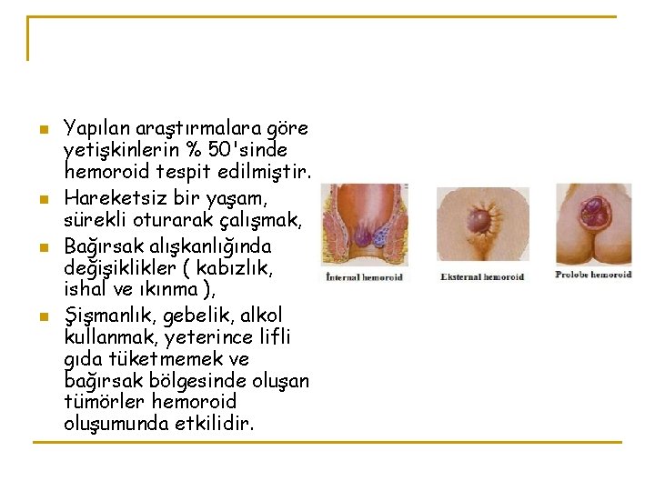 n n Yapılan araştırmalara göre yetişkinlerin % 50'sinde hemoroid tespit edilmiştir. Hareketsiz bir yaşam,