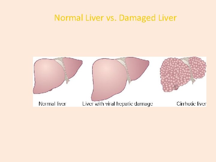 Normal Liver vs. Damaged Liver 