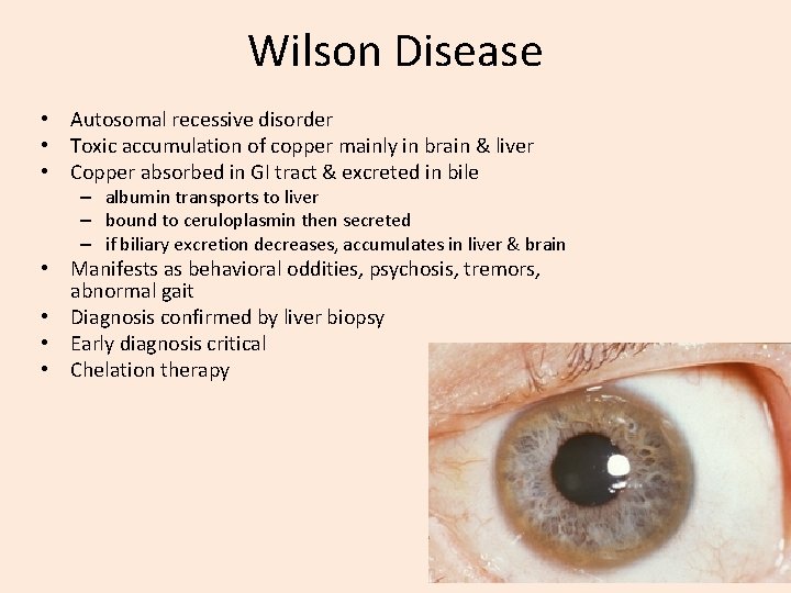 Wilson Disease • Autosomal recessive disorder • Toxic accumulation of copper mainly in brain