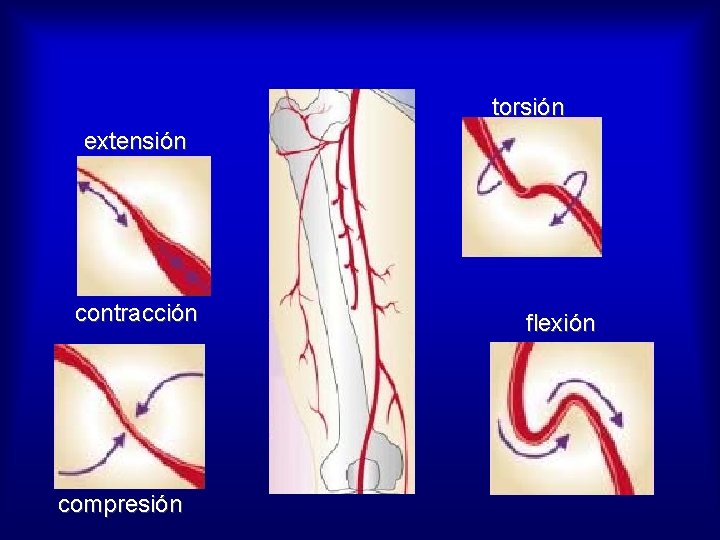 torsión extensión contracción compresión flexión 