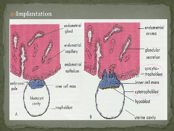  Implantation Moore, fig 3 -4 