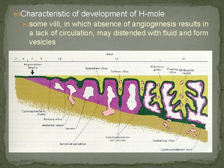  Characteristic of development of H-mole some villi, in which absence of angiogenesis results